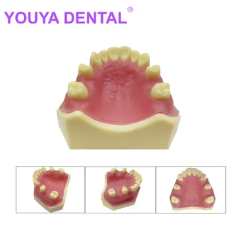 Dantų Dantų Modelis Implantas Stomatologas Studentas Studijuoja Mokymo Modeliai Odontologijos Praktikos Typodont Demonstravimo Priemonių Produktus